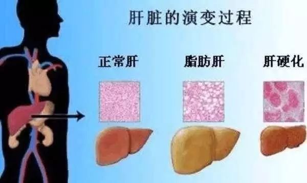 草甘膦除草剂_除草剂草甘膦的作用_剂甘草除草膦效果好吗